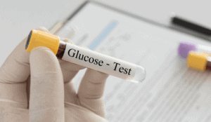 4 Ways to Test for Type 2 Diabetes